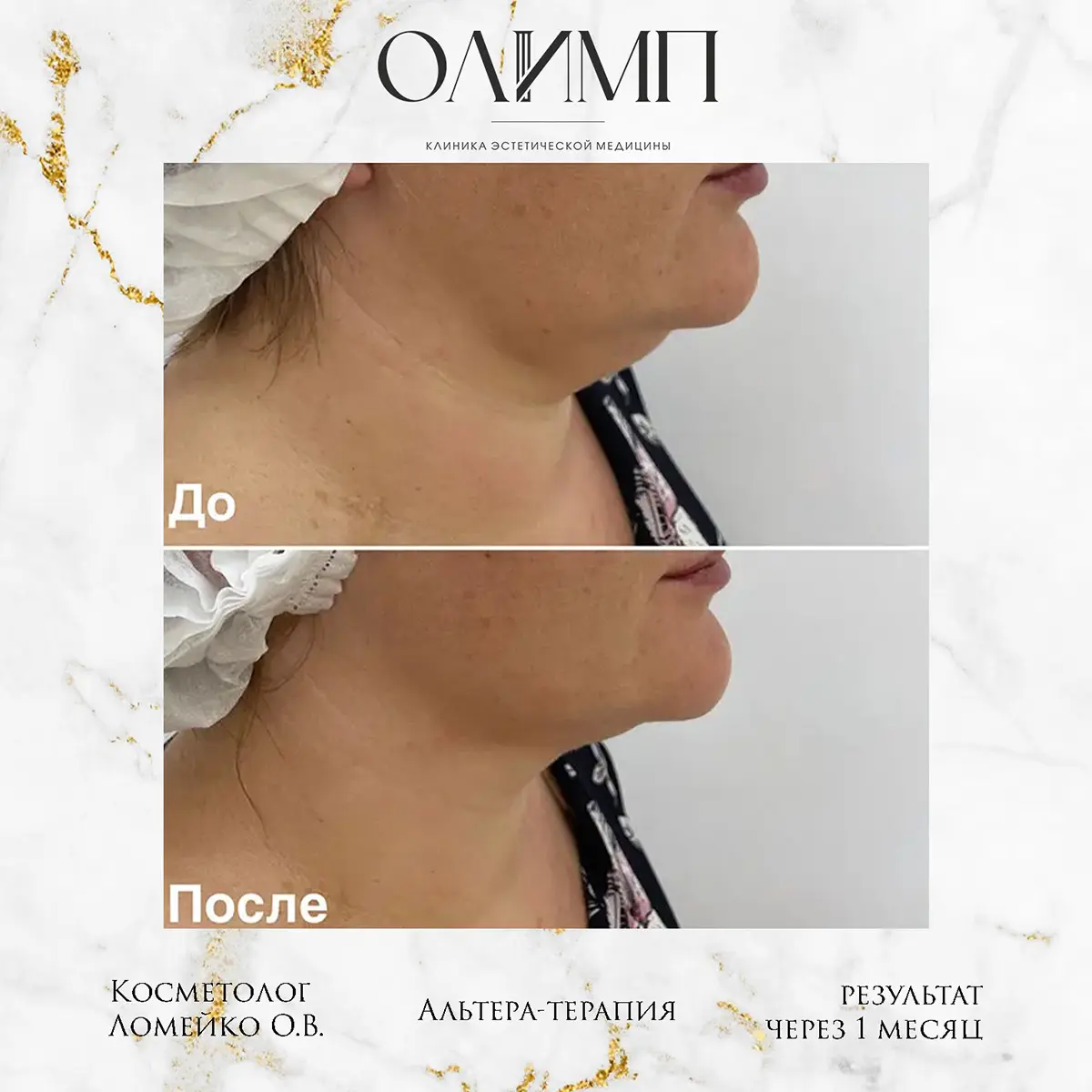 Результат операции — фотография 6