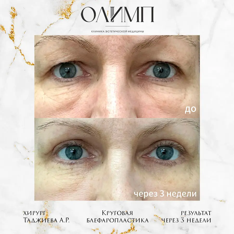 Работа врача Таджиева Айгуль Рахмонкуловна — фотография 2