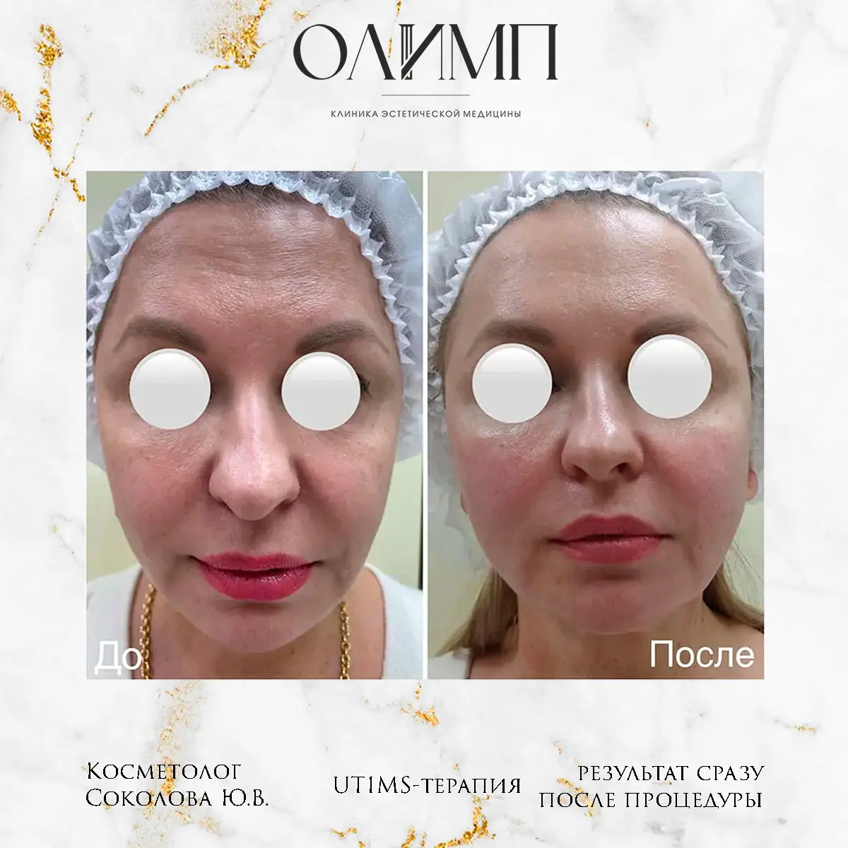 Результат операции — фотография 1