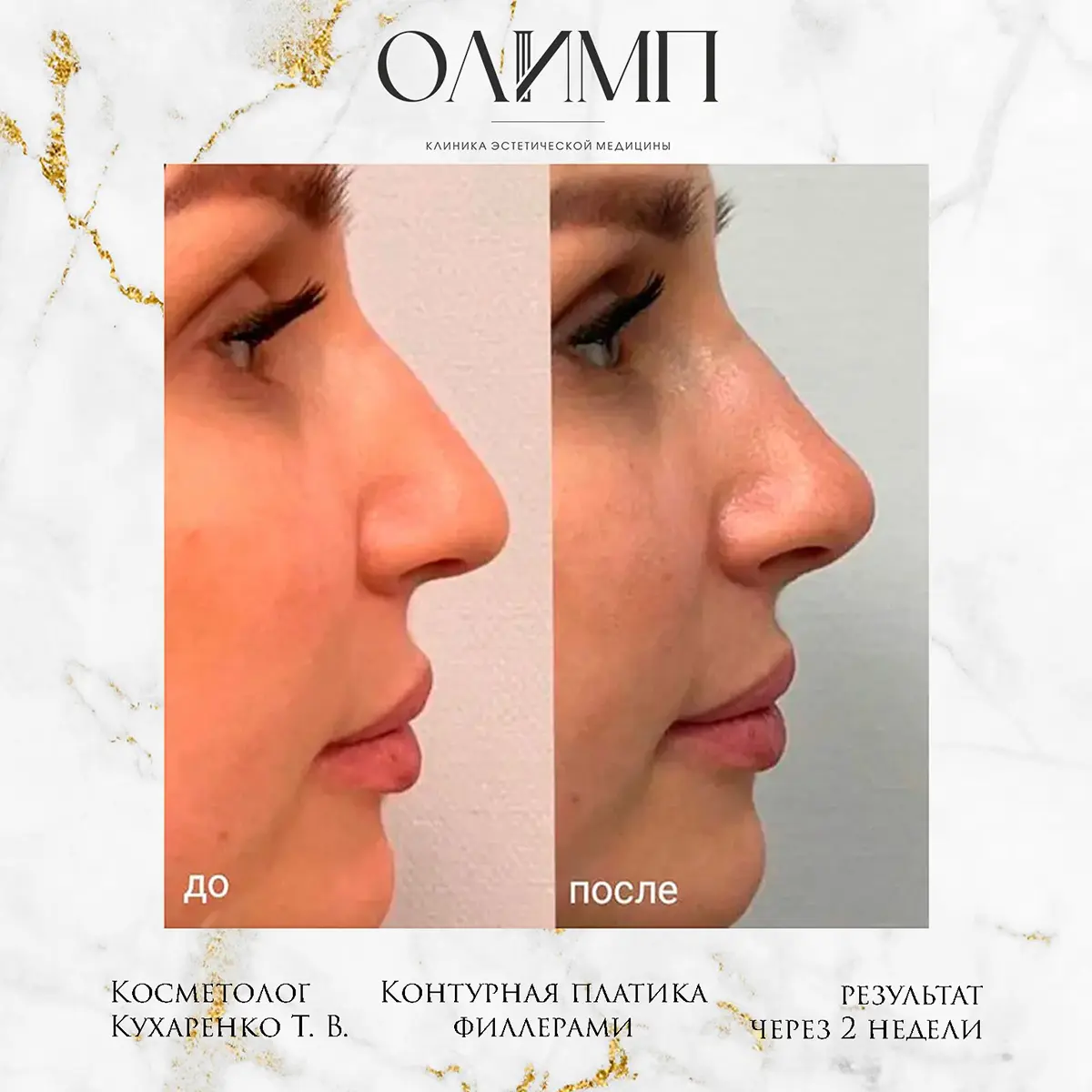 Результат операции — фотография 5