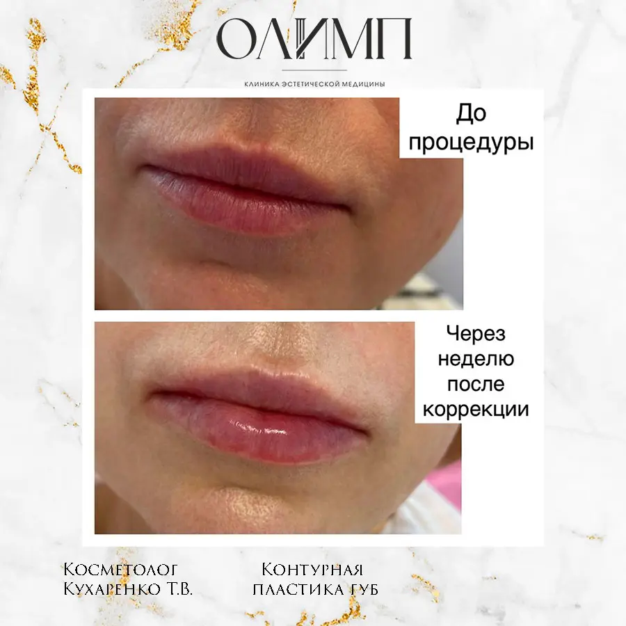 Результат операции — фотография 48