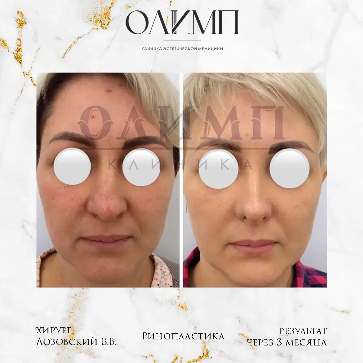 Работа врача Лозовский Виталий Валерьевич — фотография 52