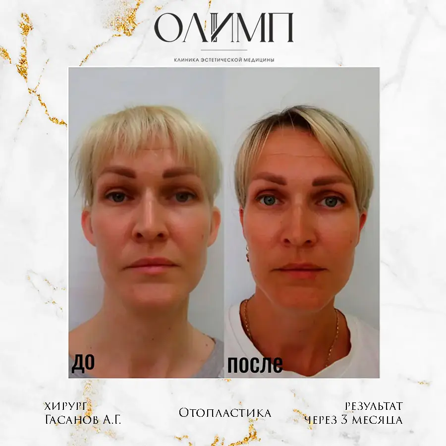 Результат операции — фотография 3