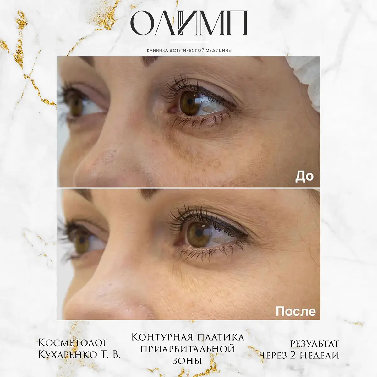 Результат операции — фотография 3