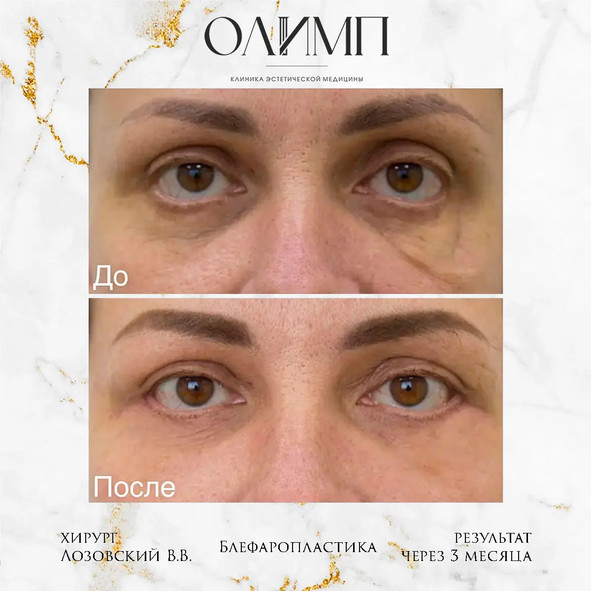 Работа врача Лозовский Виталий Валерьевич — фотография 4