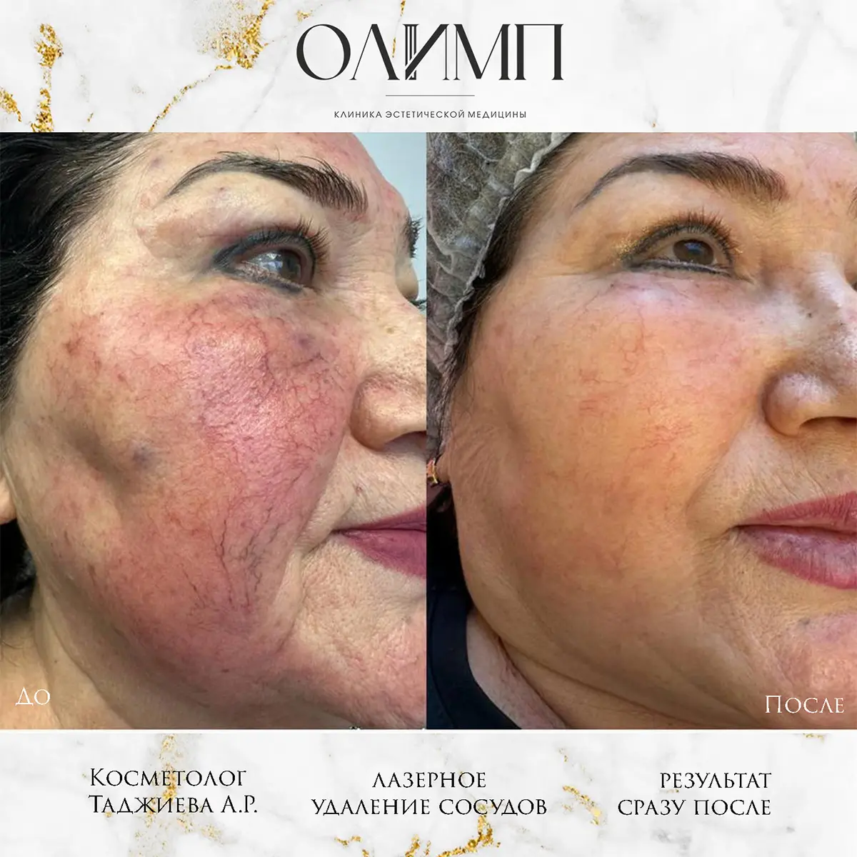 Работа врача Таджиева Айгуль Рахмонкуловна — фотография 17