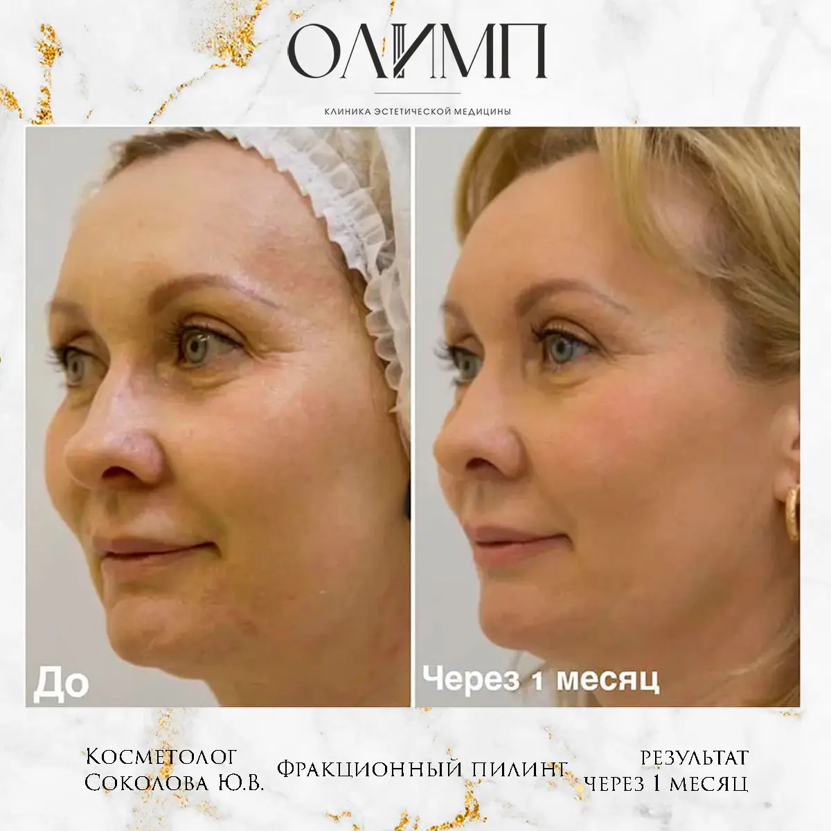 Результат операции — фотография 2