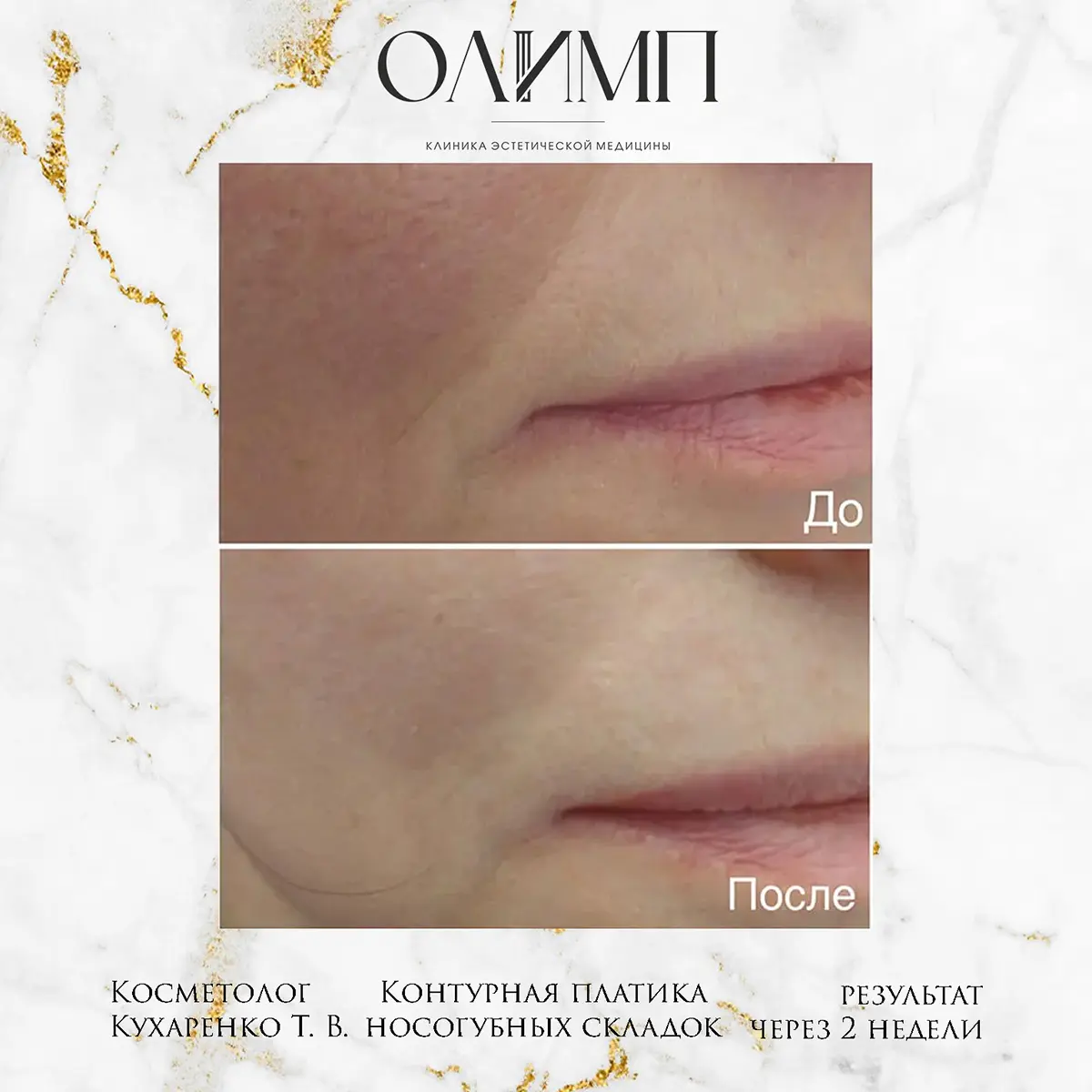 Результат операции — фотография 10