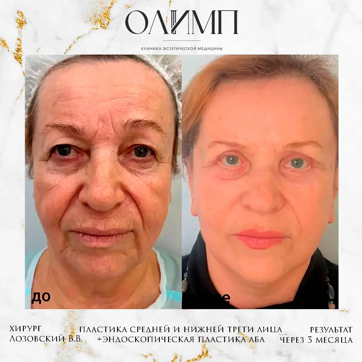 Работа врача Лозовский Виталий Валерьевич — фотография 36