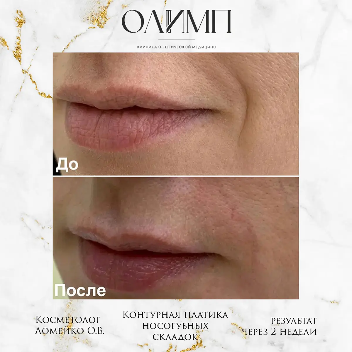 Работа врача Ломейко Ольга Владимировна — фотография 12