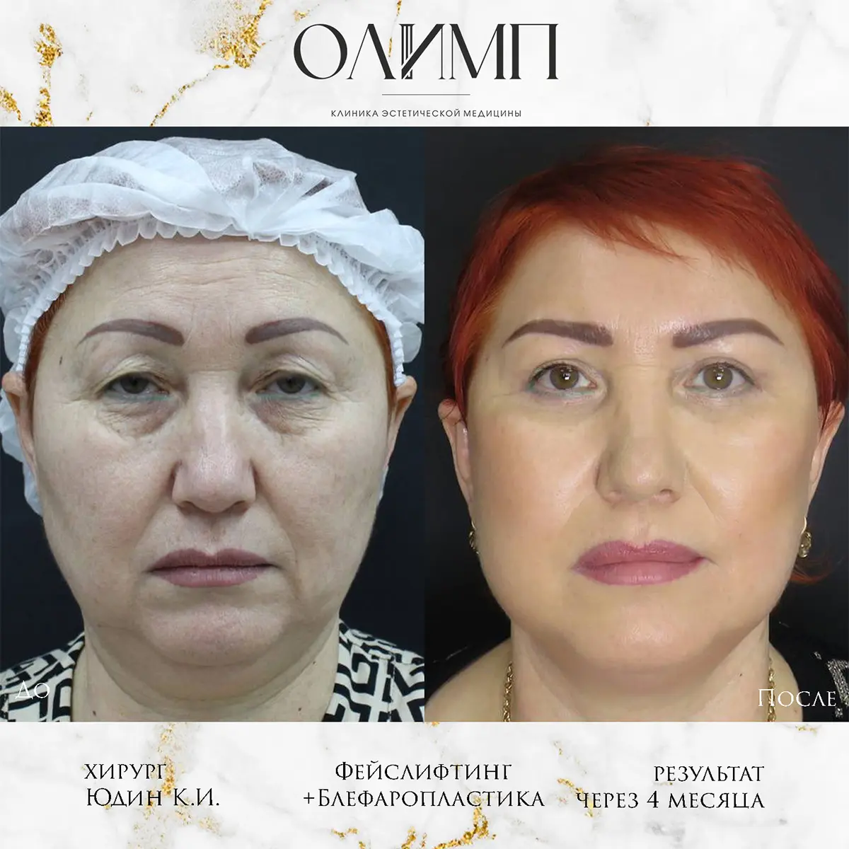 Результат операции — фотография 17