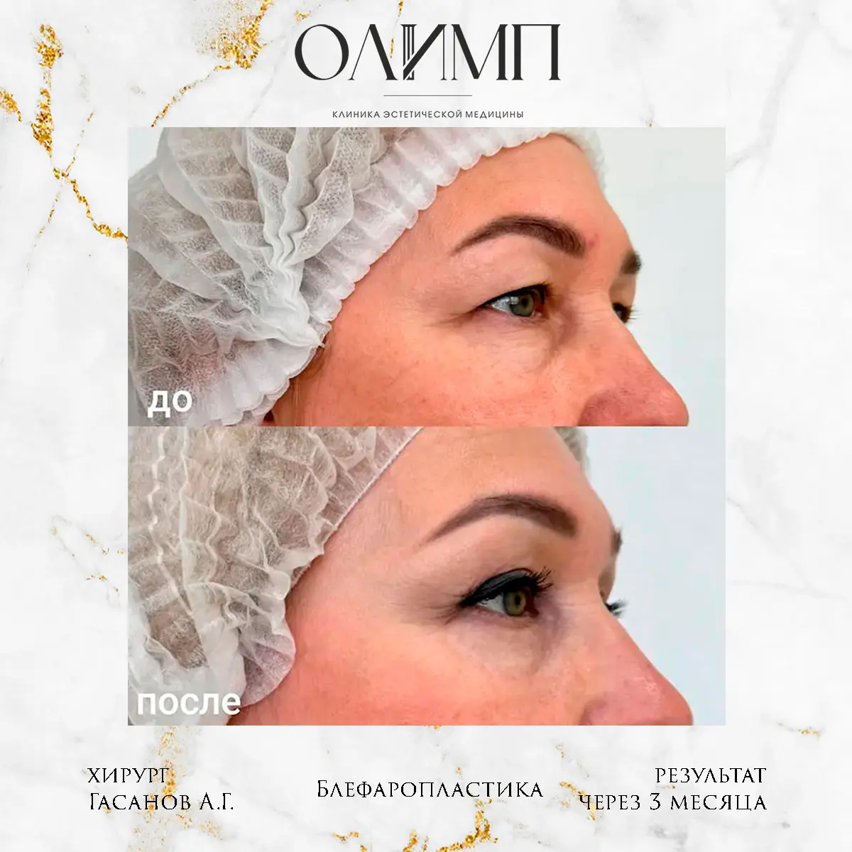 Результат операции — фотография 30