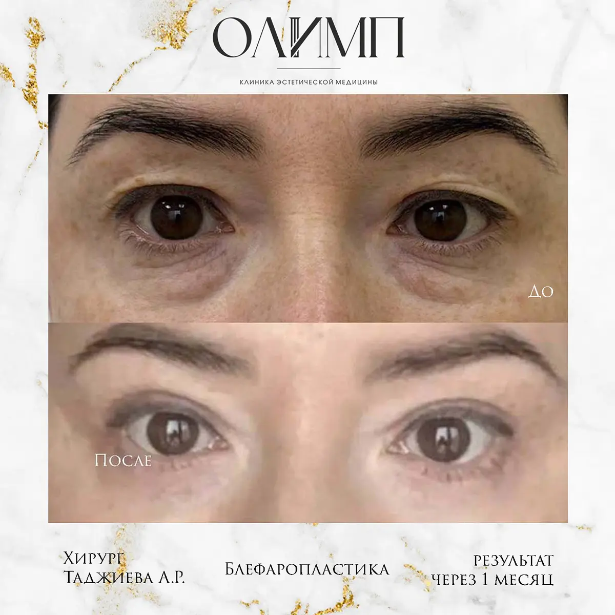 Работа врача Таджиева Айгуль Рахмонкуловна — фотография 3
