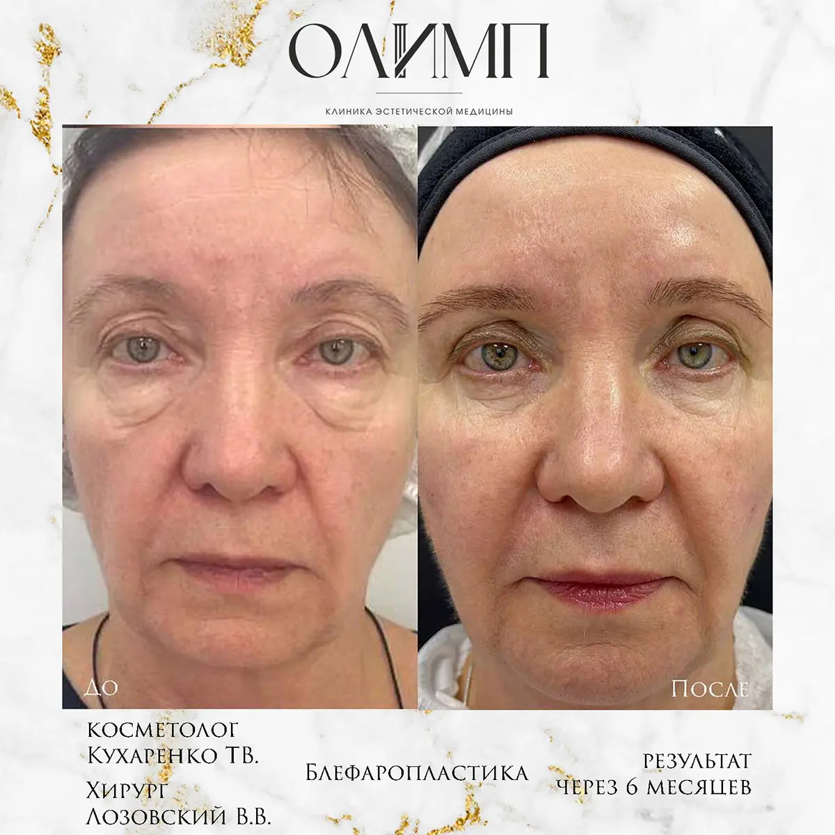 Работа врача Лозовский Виталий Валерьевич — фотография 21