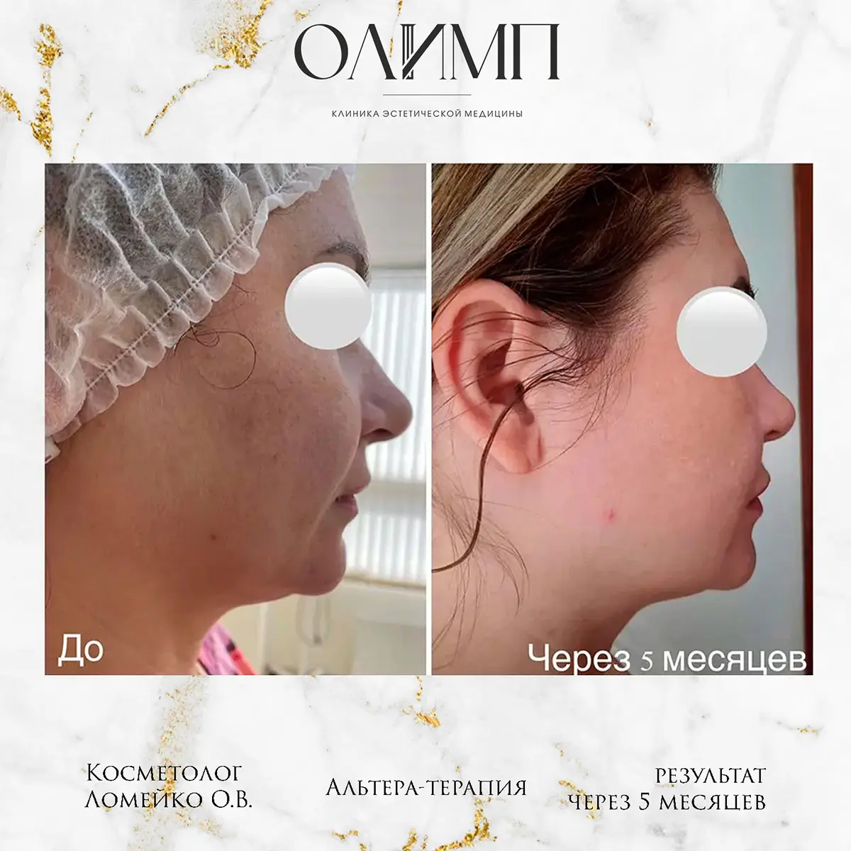 Результат операции — фотография 3