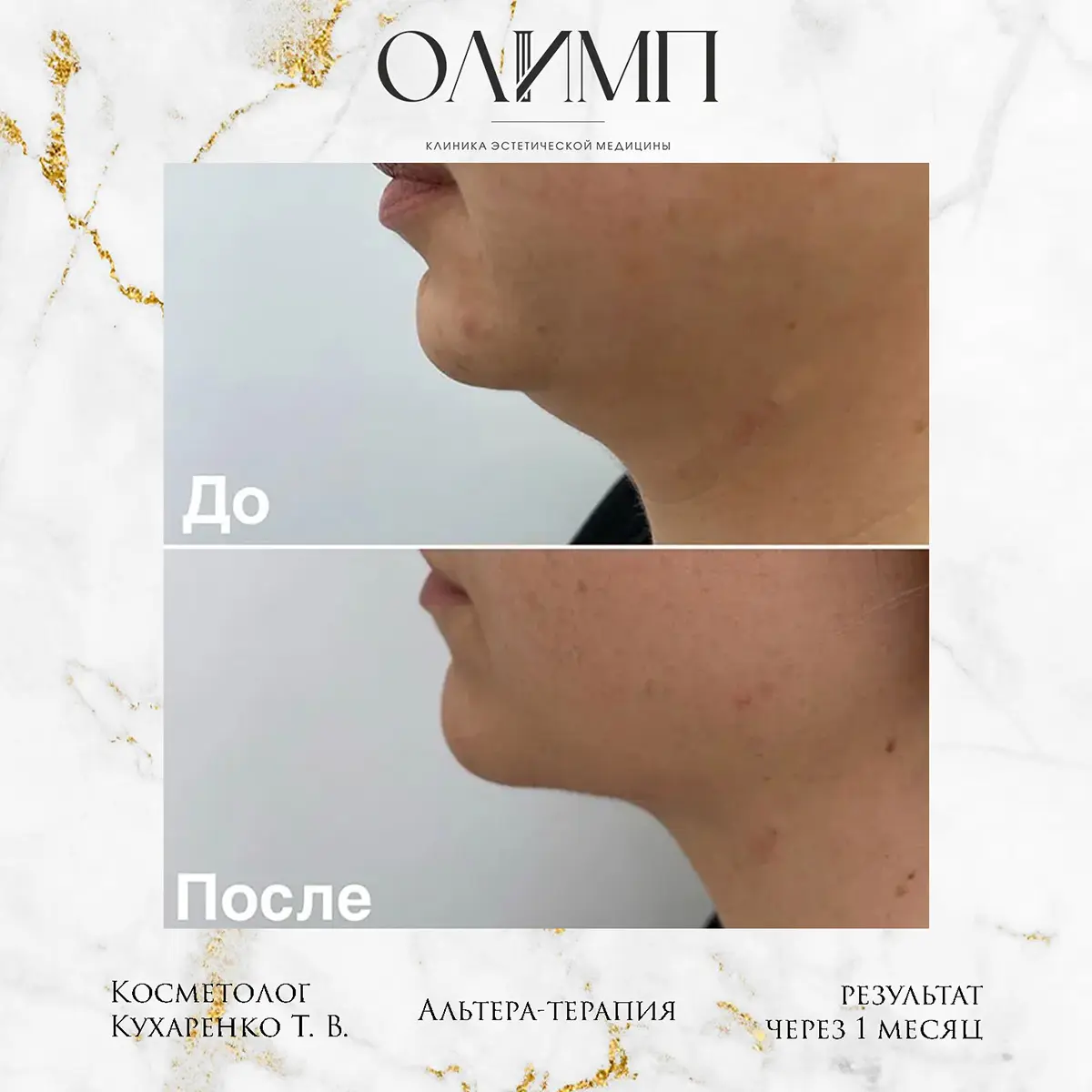 Результат операции — фотография 8
