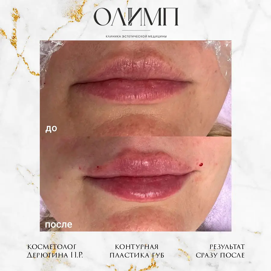 Результат операции — фотография 38