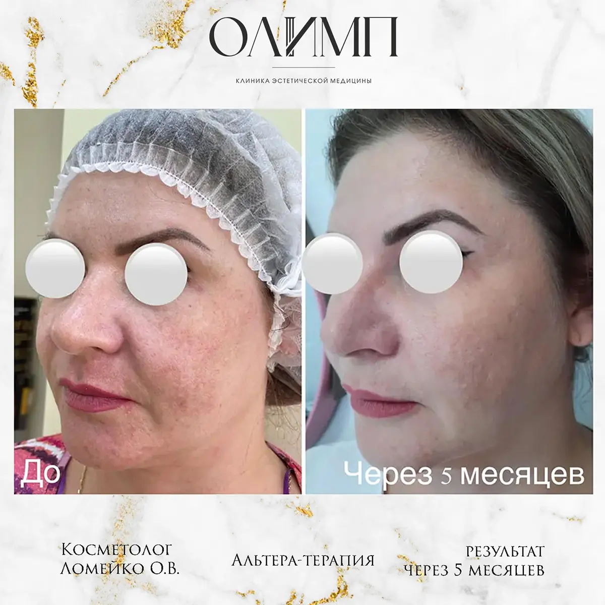 Результат операции — фотография 12