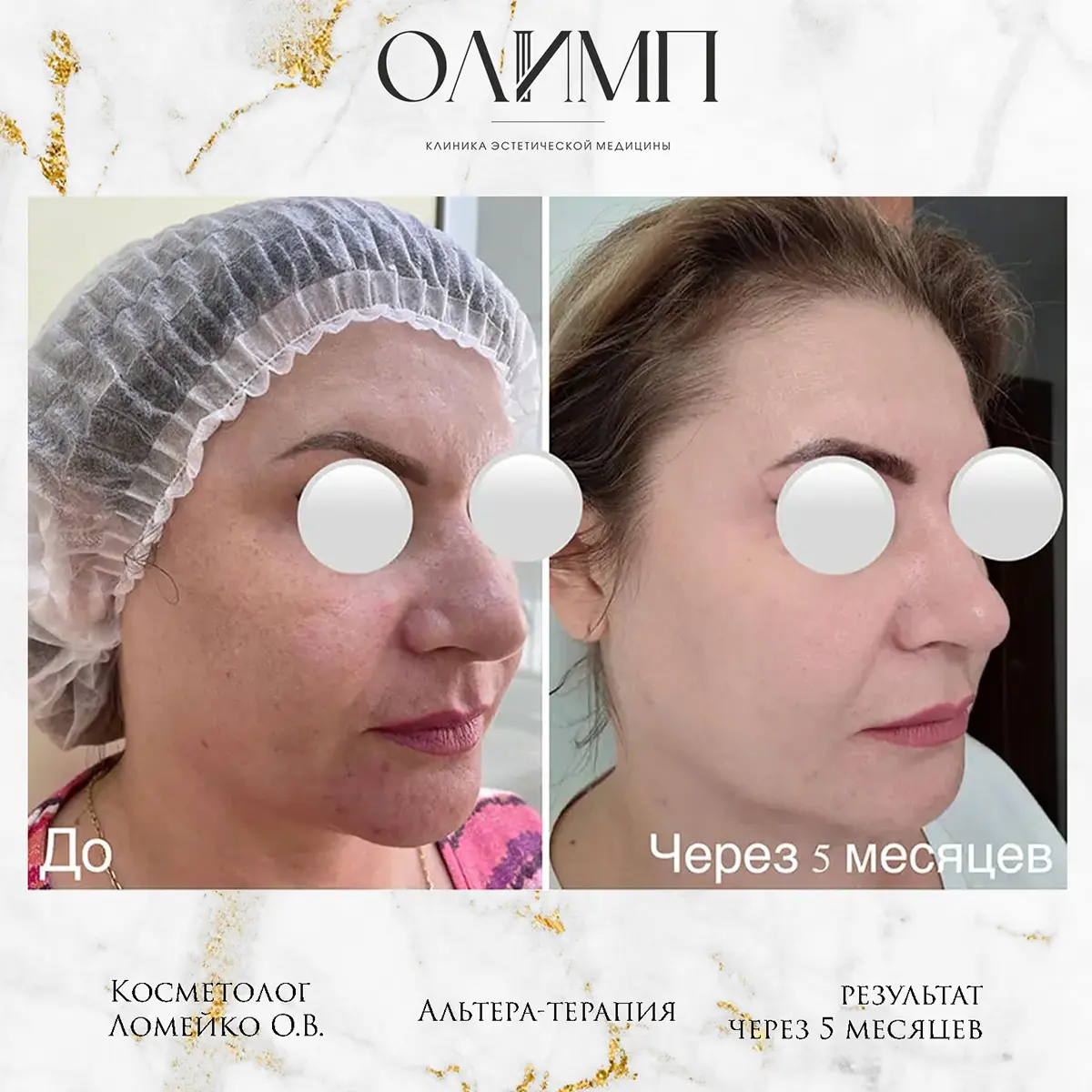 Результат операции — фотография 11