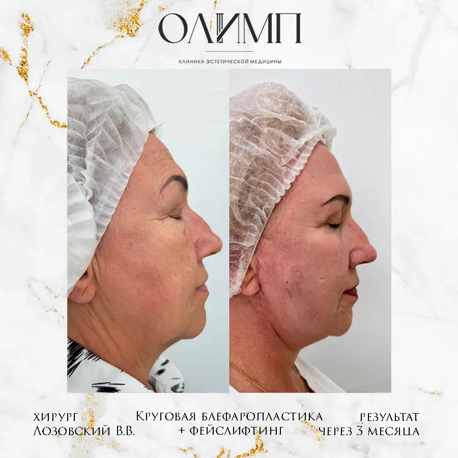 Работа врача Лозовский Виталий Валерьевич — фотография 16