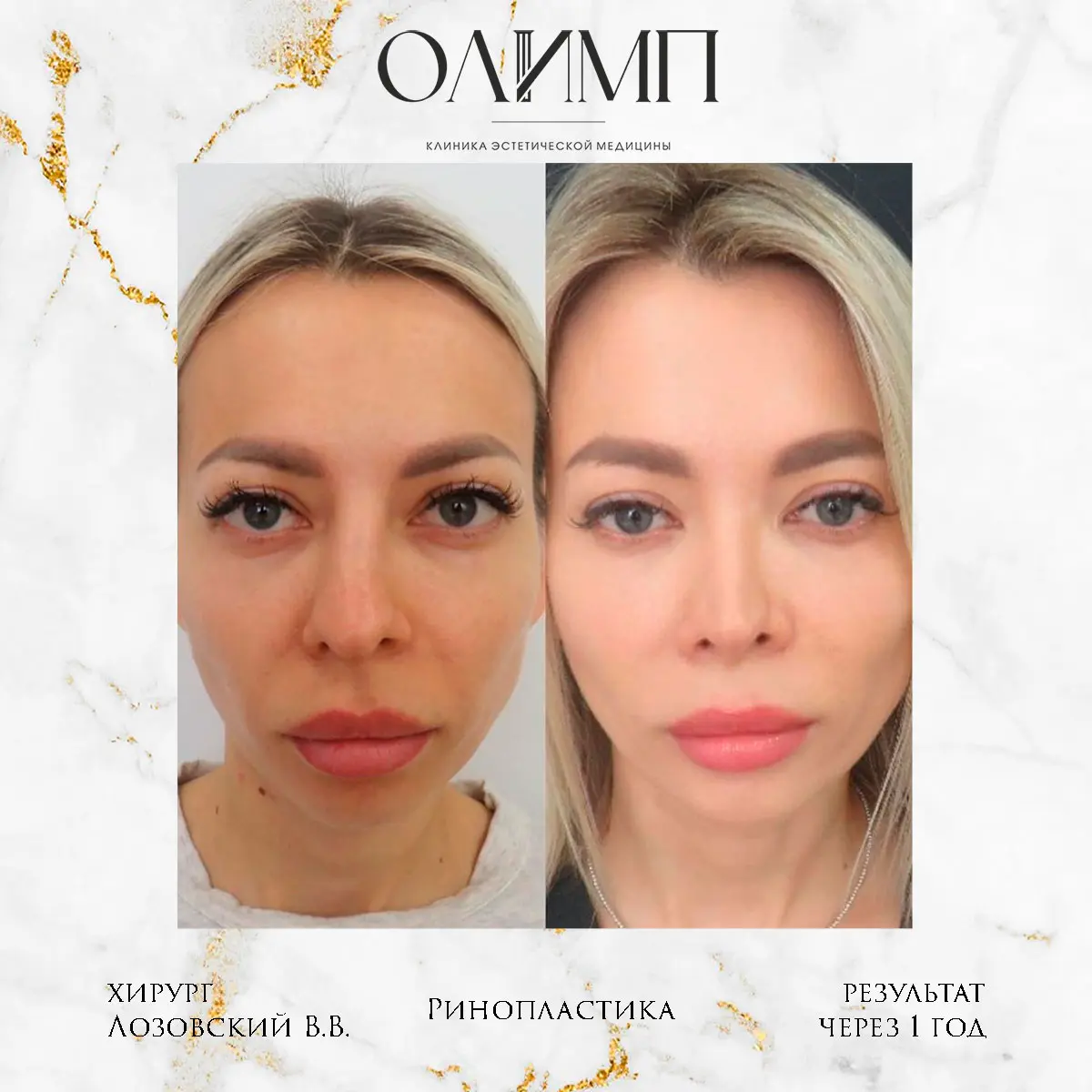 Работа врача Лозовский Виталий Валерьевич — фотография 62