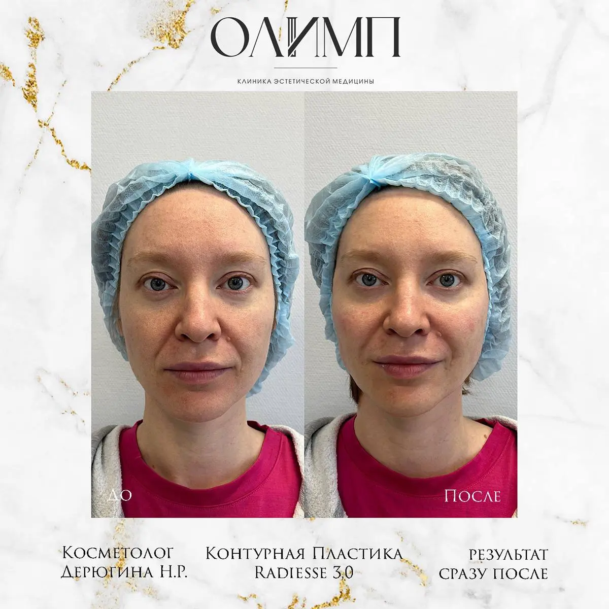 Результат операции — фотография 18