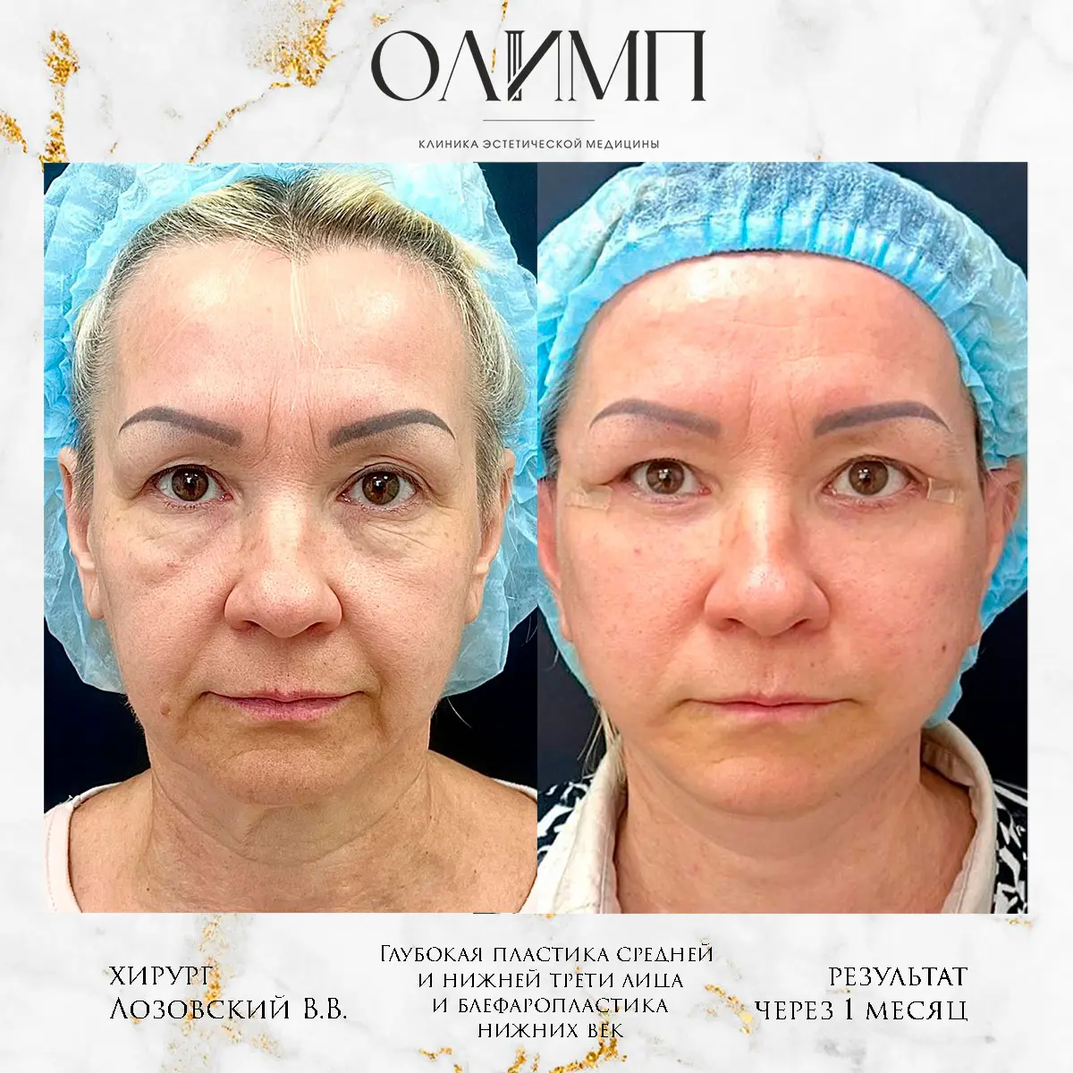 Работа врача Лозовский Виталий Валерьевич — фотография 17