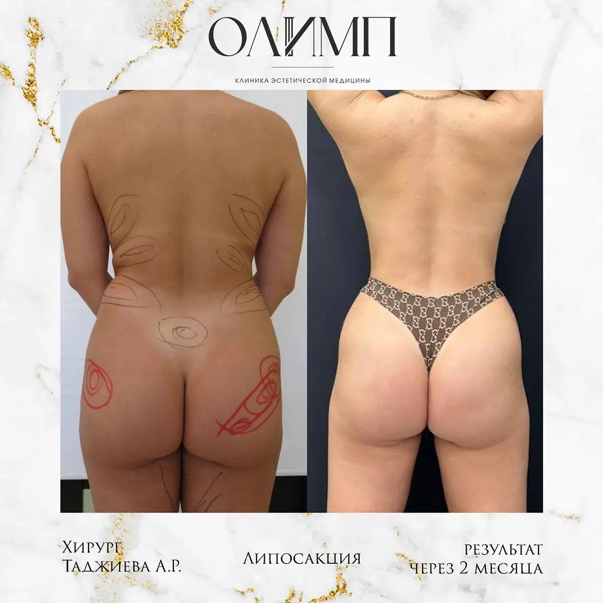 Работа врача Таджиева Айгуль Рахмонкуловна — фотография 4