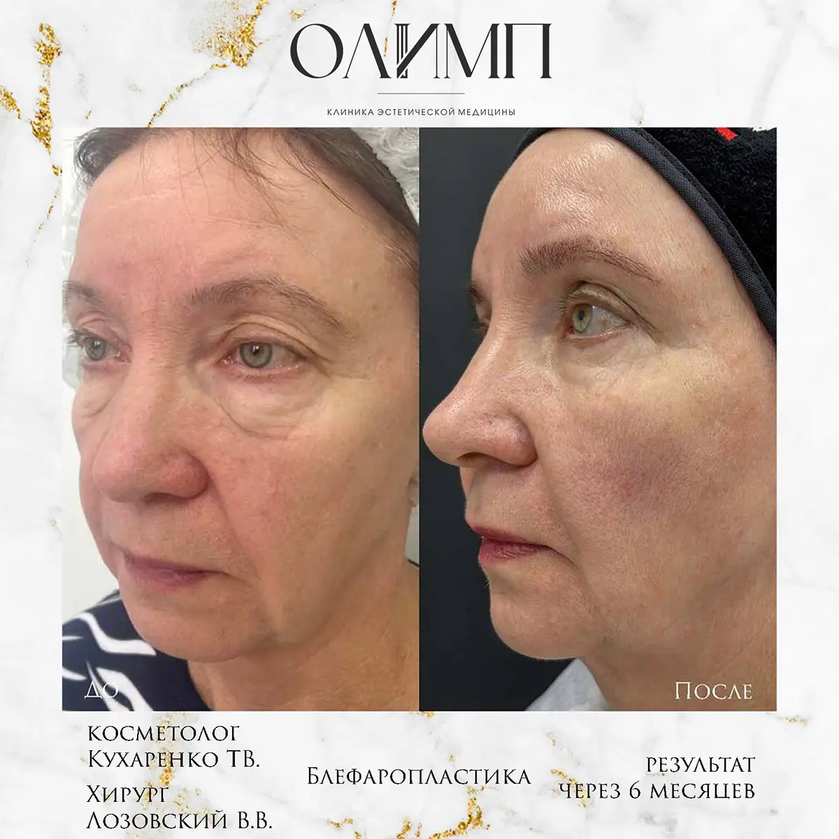 Работа врача Лозовский Виталий Валерьевич — фотография 19