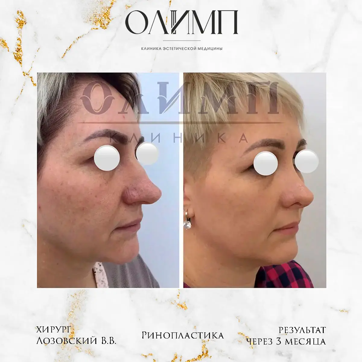 Работа врача Лозовский Виталий Валерьевич — фотография 53