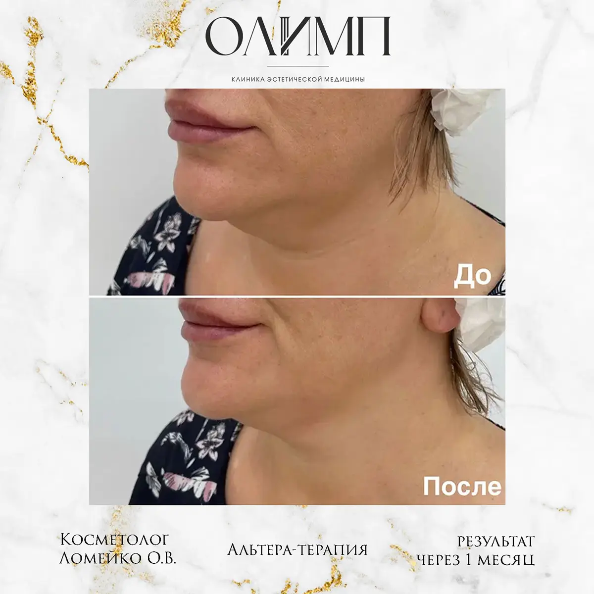 Результат операции — фотография 5