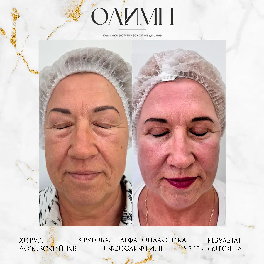 Работа врача Лозовский Виталий Валерьевич — фотография 14