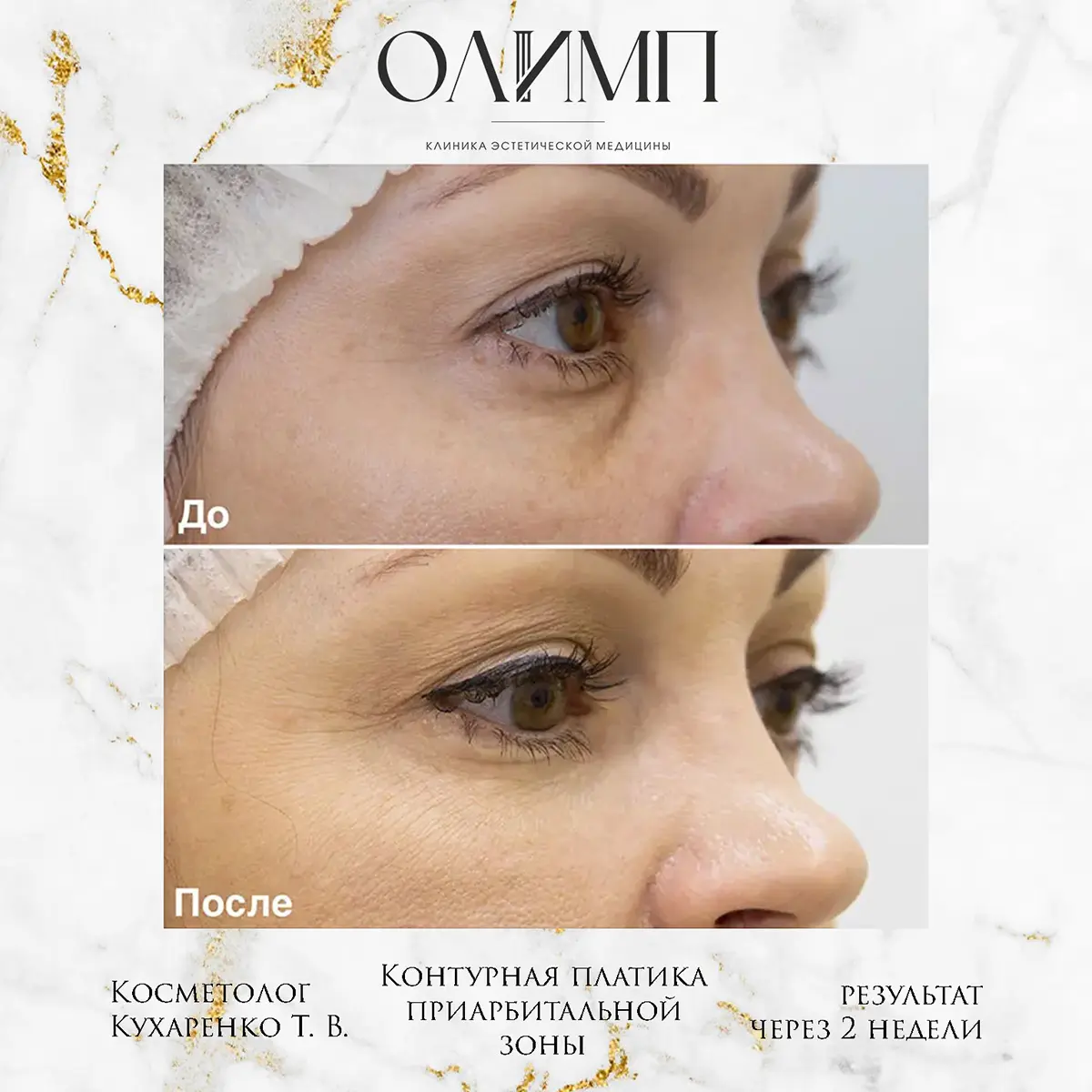Результат операции — фотография 2