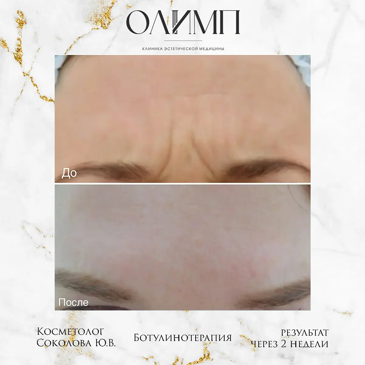 Результат операции — фотография 1