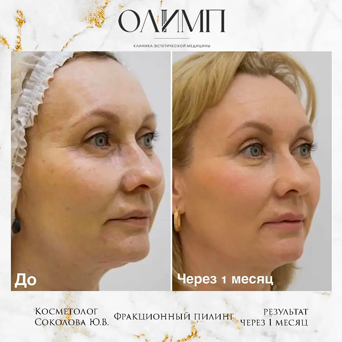 Результат операции — фотография 1