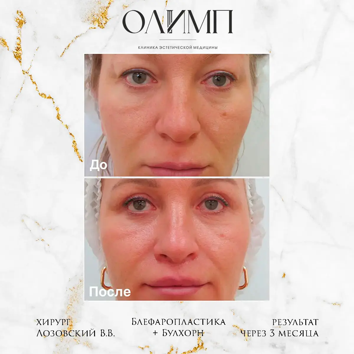 Работа врача Лозовский Виталий Валерьевич — фотография 2