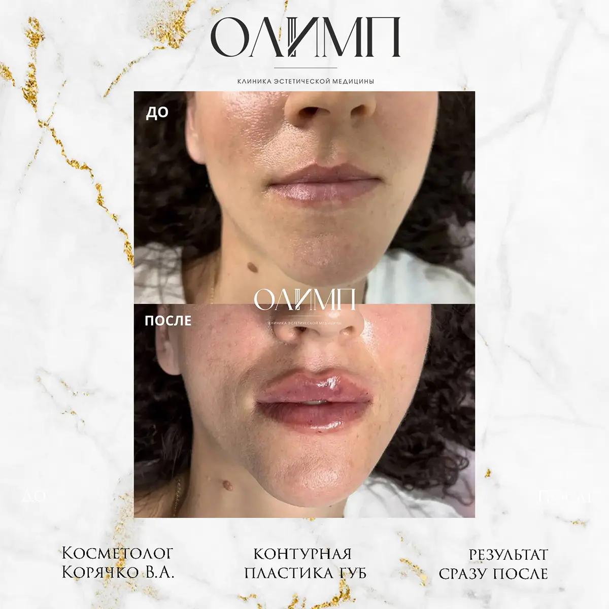 Результат операции — фотография 52