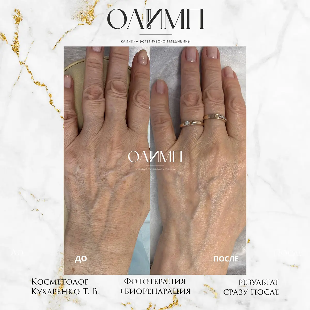 Результат операции — фотография 2