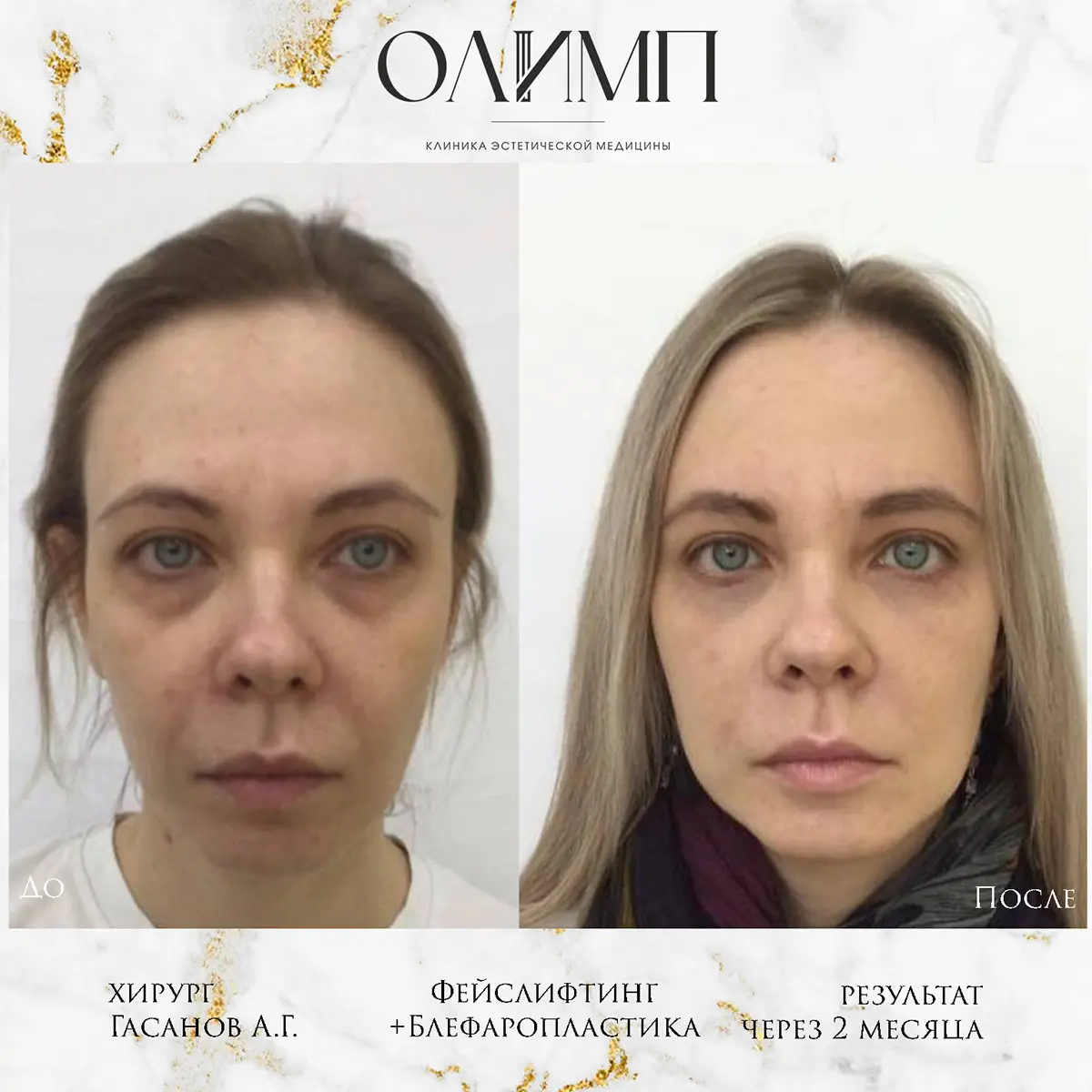 Работа врача Гасанов Ахмед Гасанович — фотография 21