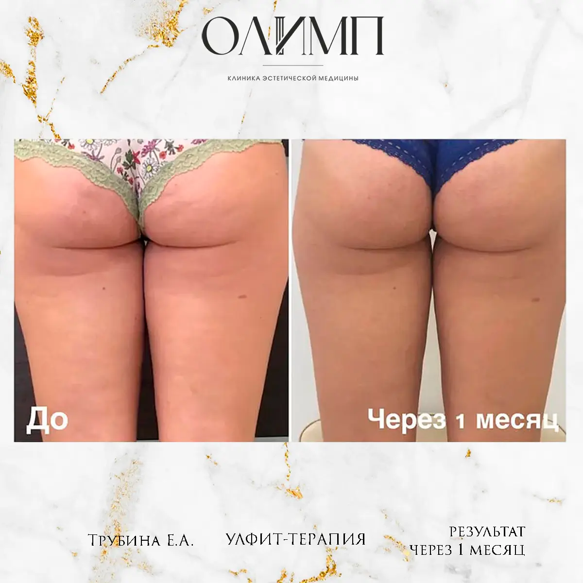 Результат операции — фотография 13