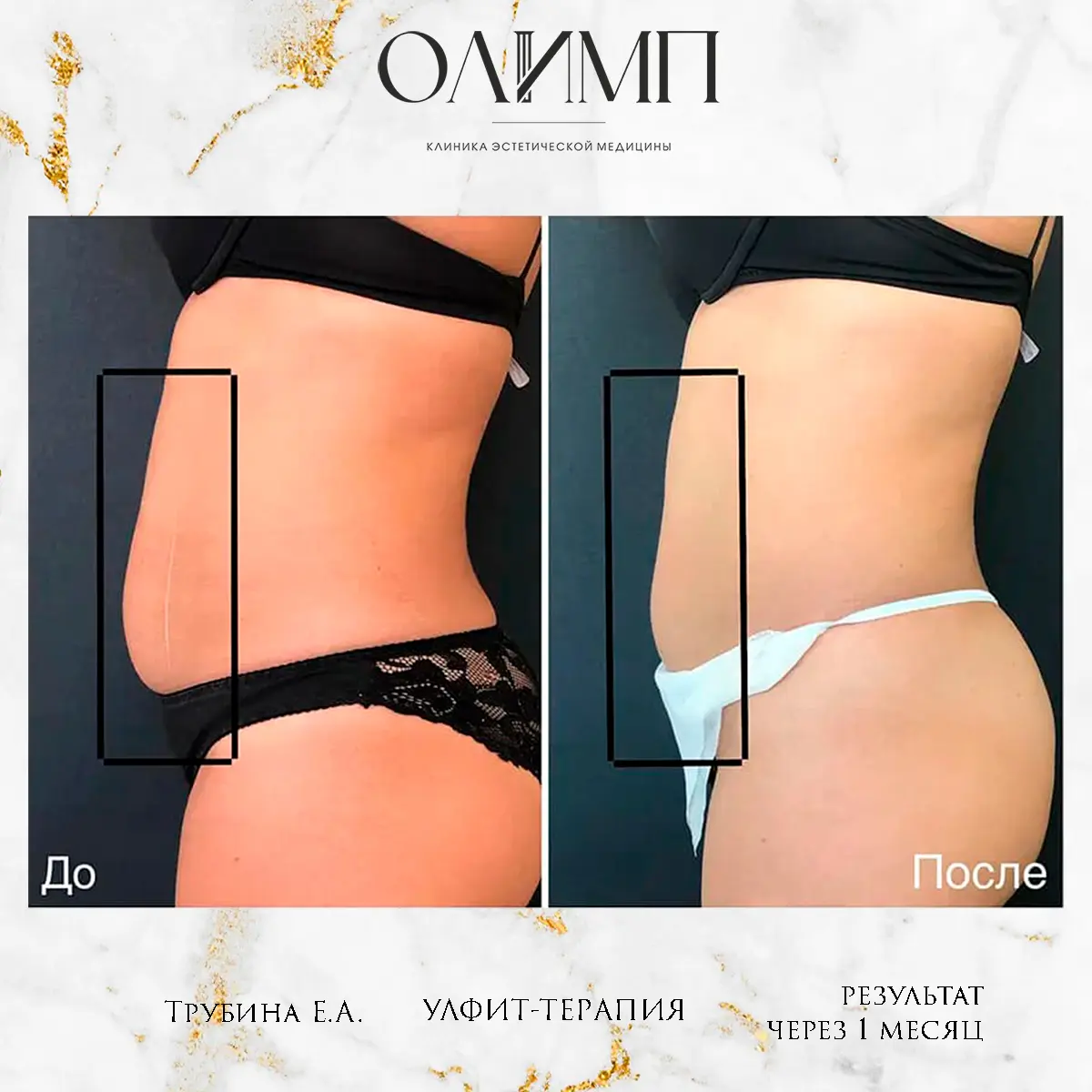 Результат операции — фотография 9