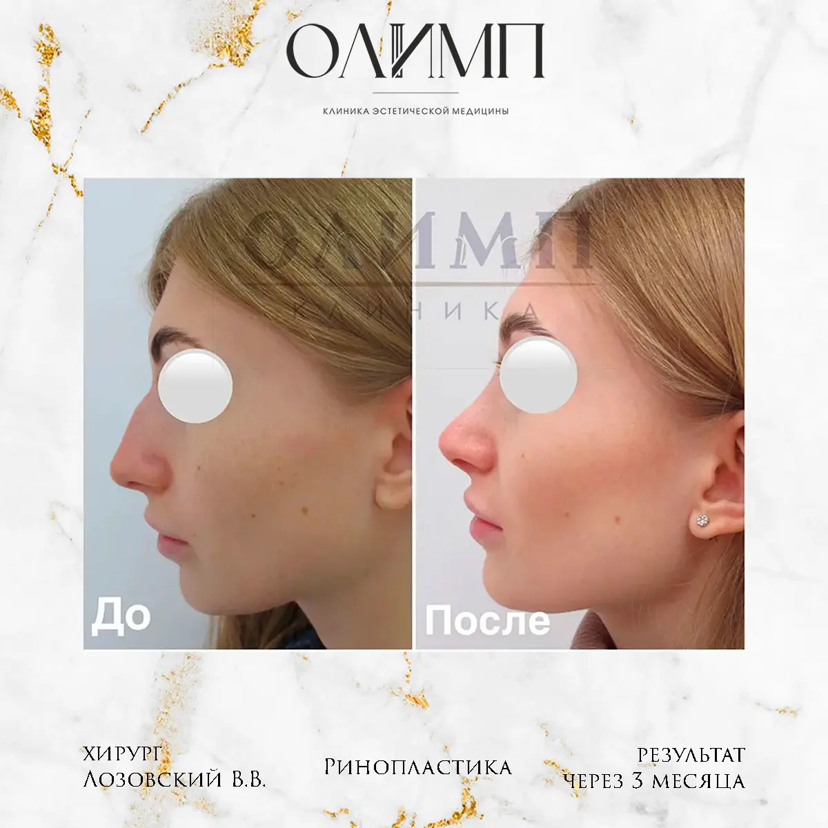 Работа врача Лозовский Виталий Валерьевич — фотография 50