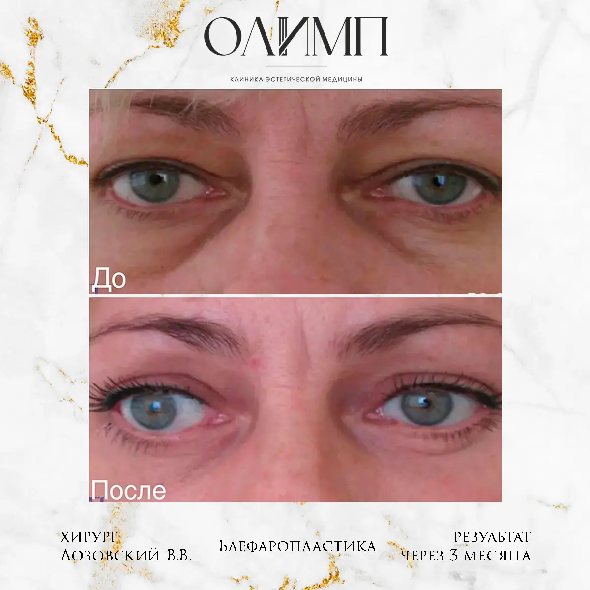 Работа врача Лозовский Виталий Валерьевич — фотография 1