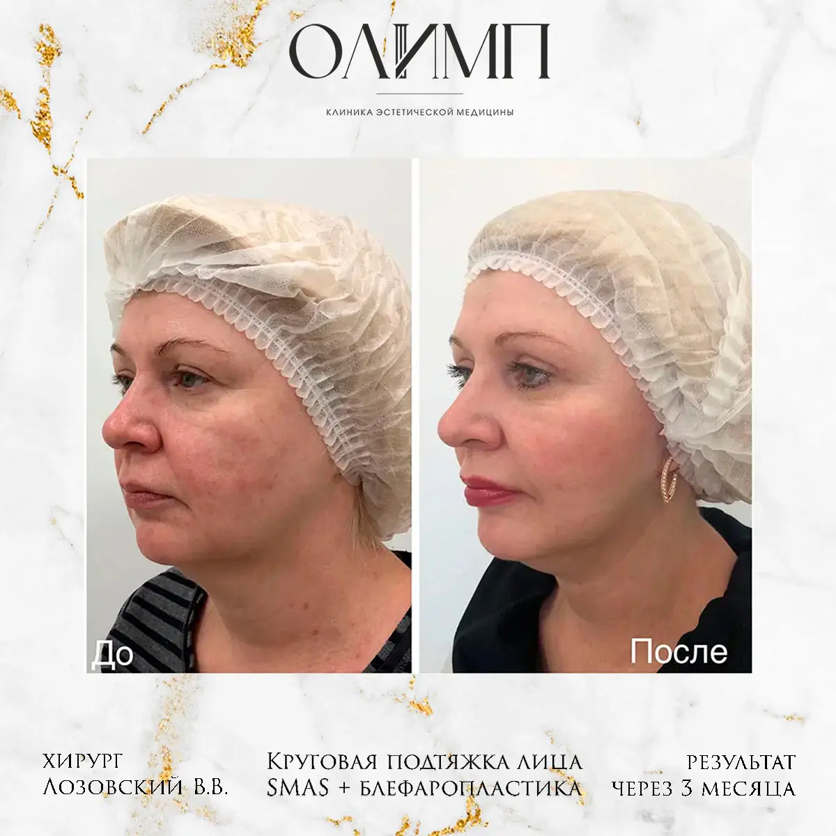 Работа врача Лозовский Виталий Валерьевич — фотография 26