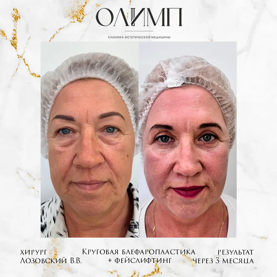 Работа врача Лозовский Виталий Валерьевич — фотография 15