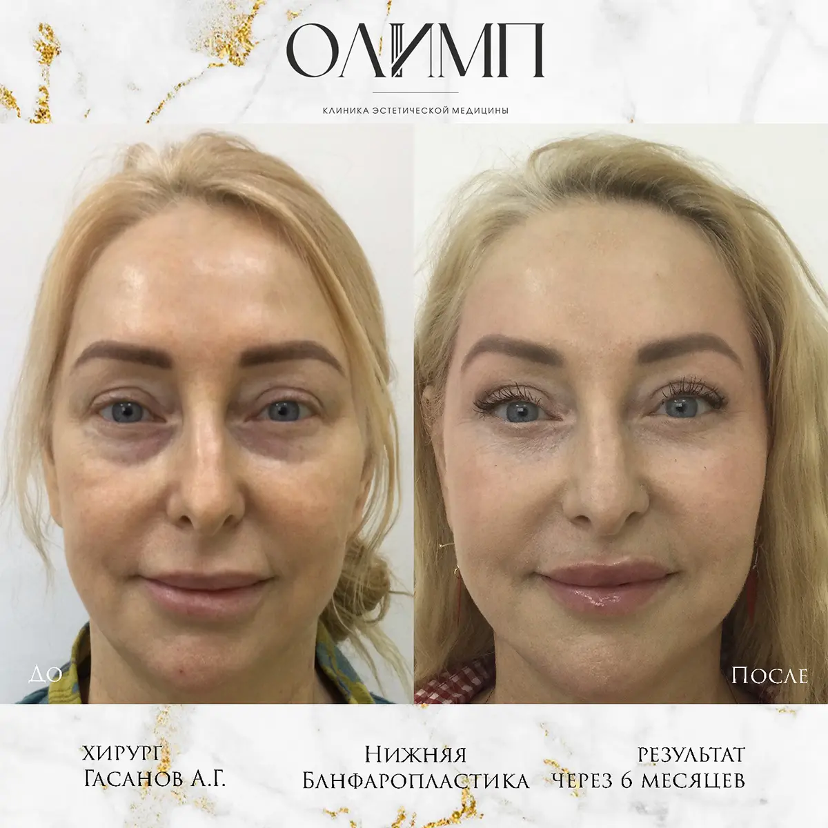 Результат операции — фотография 53
