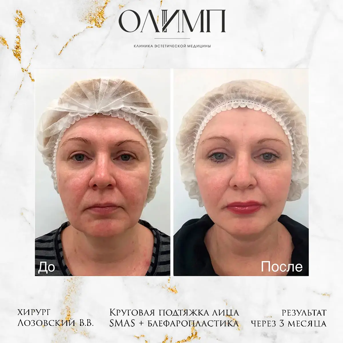 Работа врача Лозовский Виталий Валерьевич — фотография 25