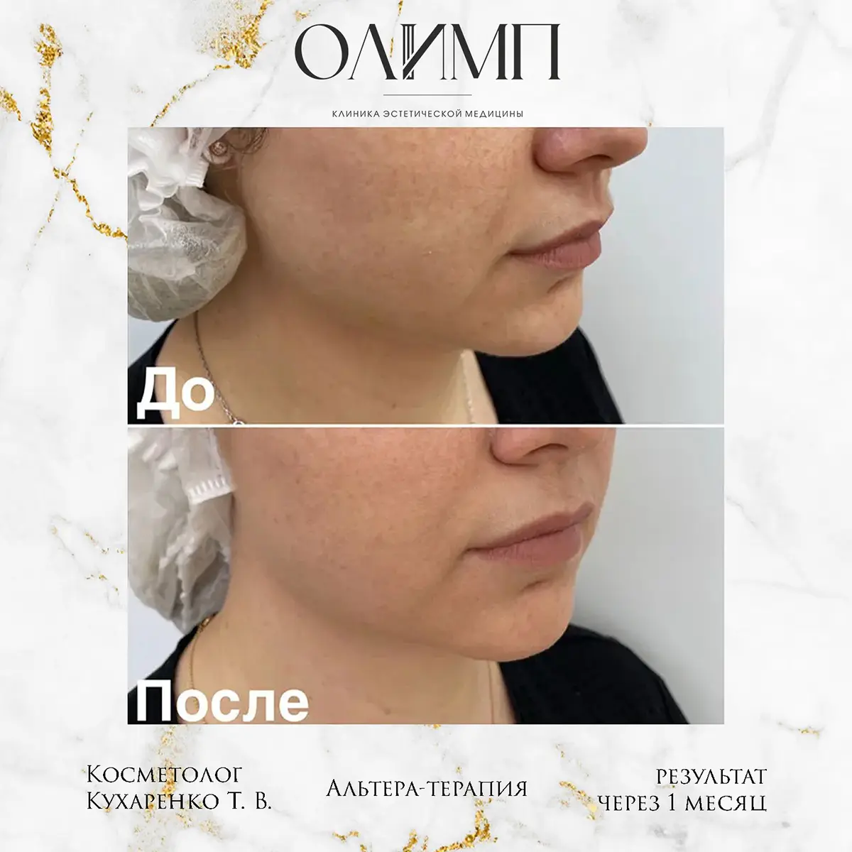 Альтера терпия 13