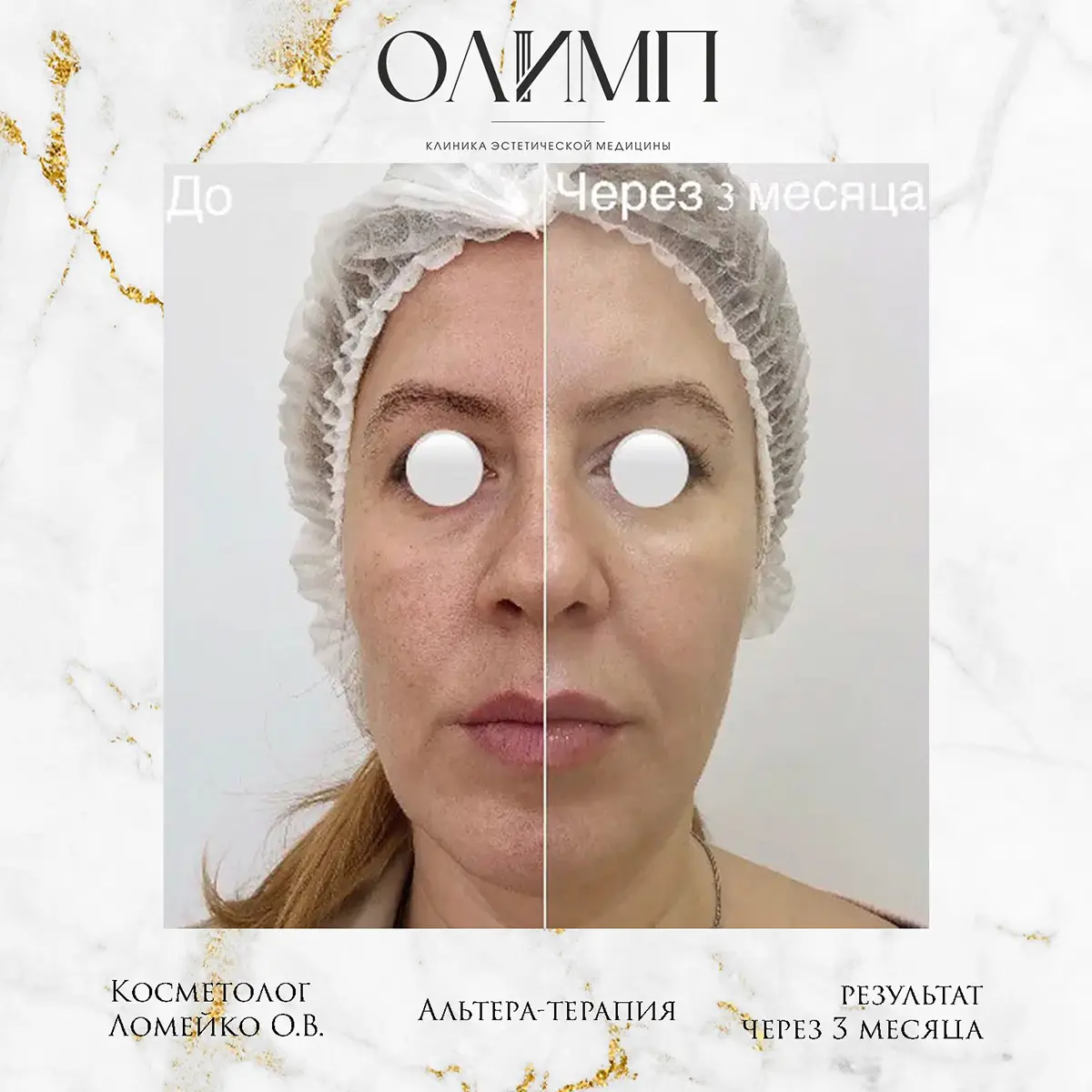 Альтера терпия 8